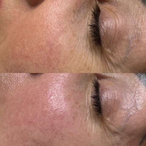 Beauty treatment result