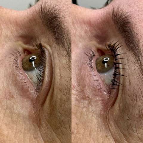 Beauty treatment result