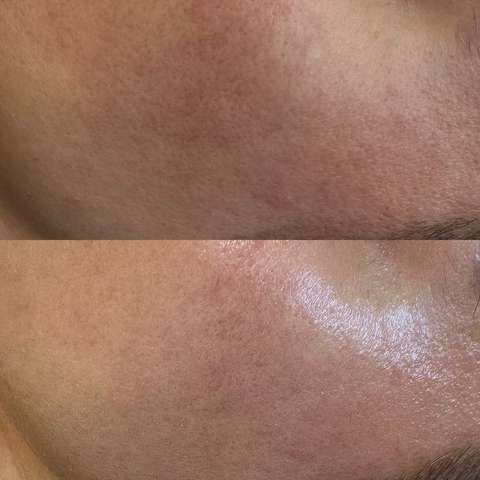 Beauty treatment result