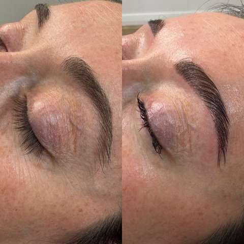 Beauty treatment result