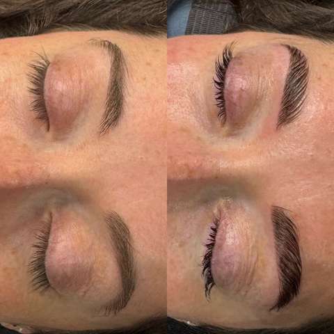 Beauty treatment result