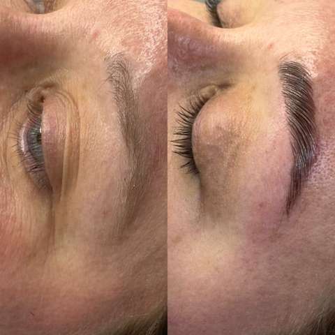 Beauty treatment result
