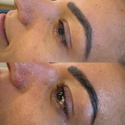 Beauty treatment result