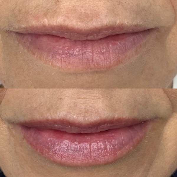Lip blush healed result