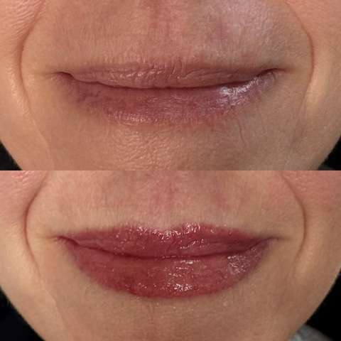 Lip blush result