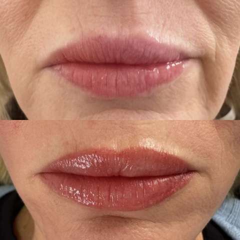 Lip blush result