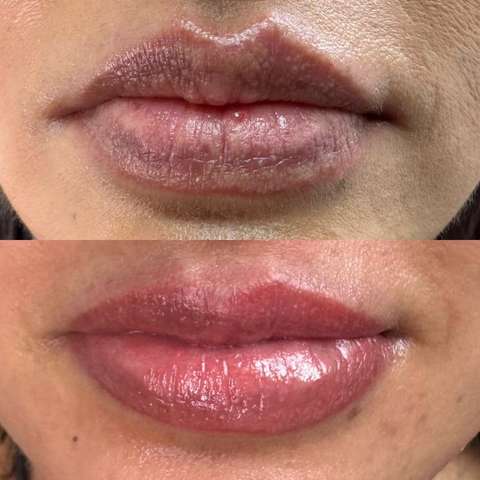 Lip blush result