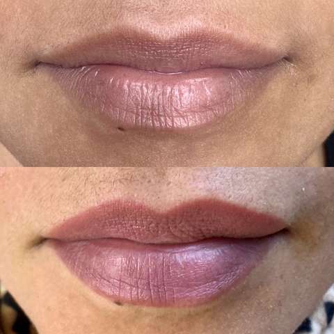 Lip blush result