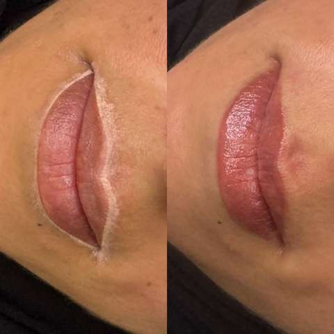 Lip blush result