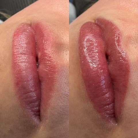 Lip blush result